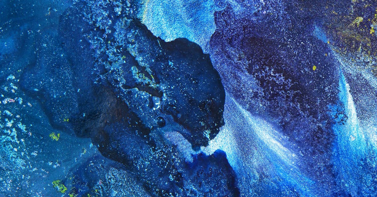 Why medical Botox is used for migraines